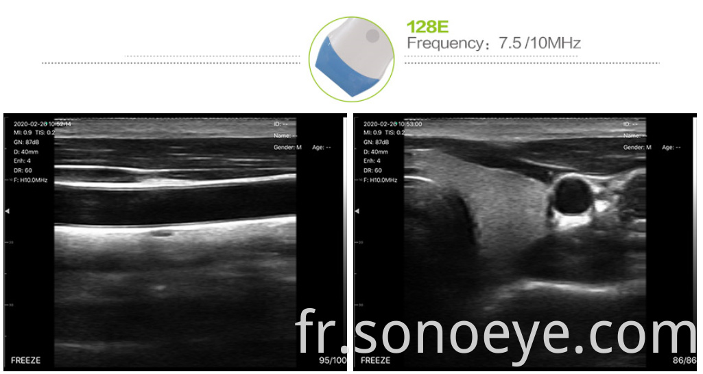 uprobe-5l